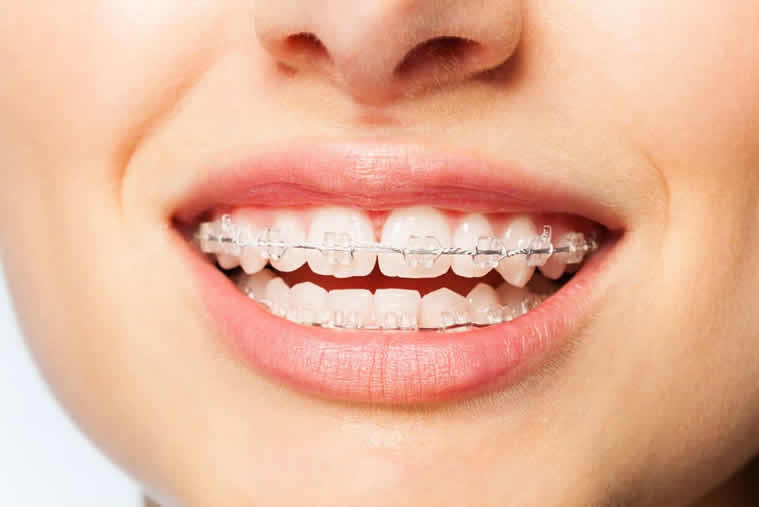 Orthodontic treatment at dr moin holy dental care south mumbai