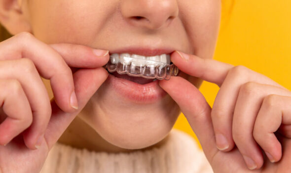 Orthodontic treatment at dr moin holy dental care south mumbai