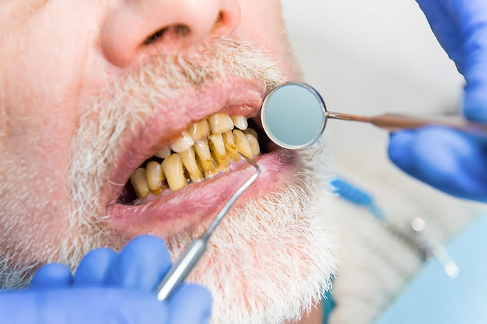 Geriatric dentistry at dr moin holy dental care south mumbai