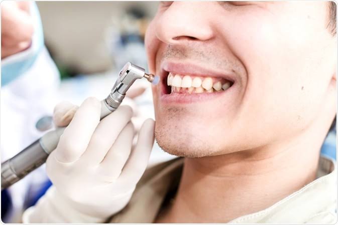 Teeth cleaning and polishing treatment at dr moin holy dental care south mumbai