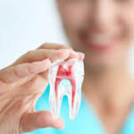 painless root canal treatment 4