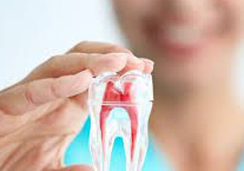 painless root canal treatment 4